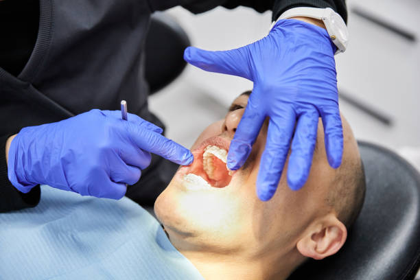 Best Emergency Root Canal Therapy in Meridian, TX